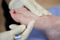 Podiatry Chiropody Sports Injury Sheffield